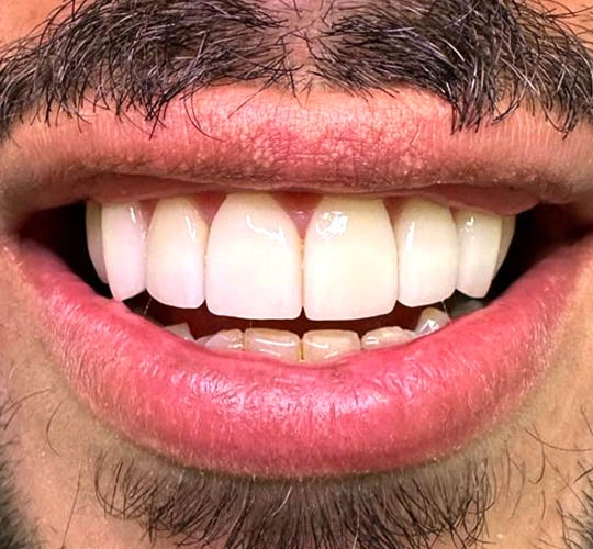 Sorriso transformado após tratamento com dentista no Morumbi